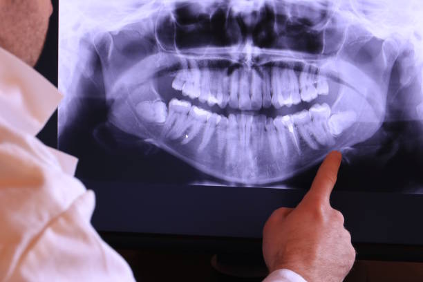 Best Emergency Gum Treatment in Newburg, WI