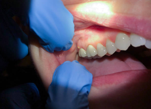 Best Emergency TMJ Treatment in Newburg, WI