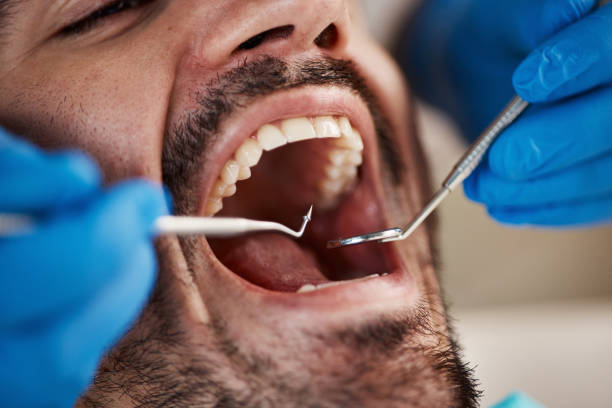 Best Emergency Tooth Extraction in Newburg, WI