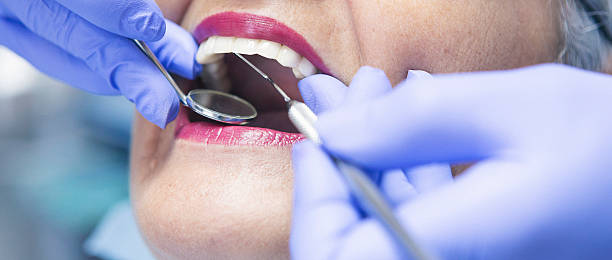 Best Emergency Denture Repair in Newburg, WI